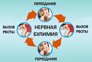 Лечение булимии в Валуйках